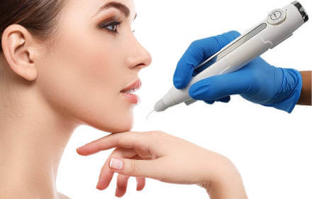 Skin Tightening with Plasma Pen Treatments - Salwa’z Beauty Salon